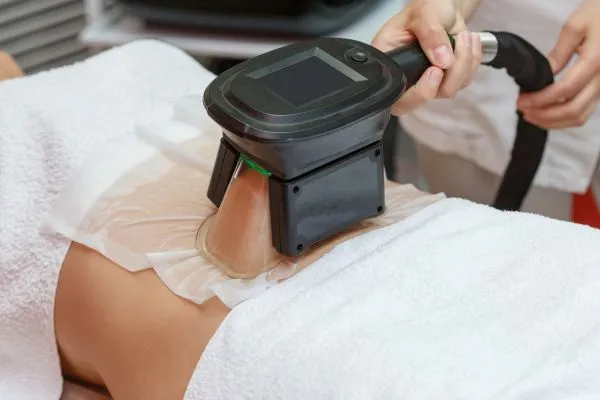Image of person having fat freezing treatment to help weight gain Scotland