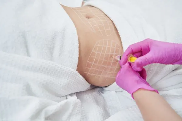 image of fat dissolving injections on love handles to help combat weight gain Scotland