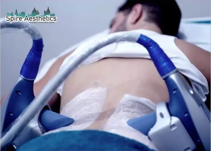 Man having fat freezing treatment done on love handles before a competitions Scotland to create a sculpted look.