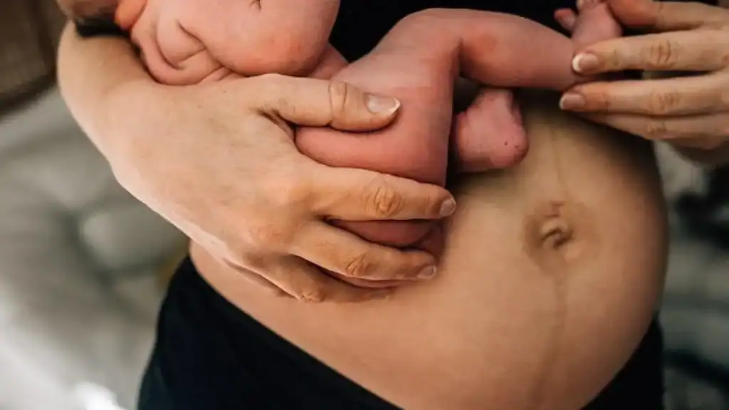 Why Is My Stomach Still Big After Pregnancy Scotland?